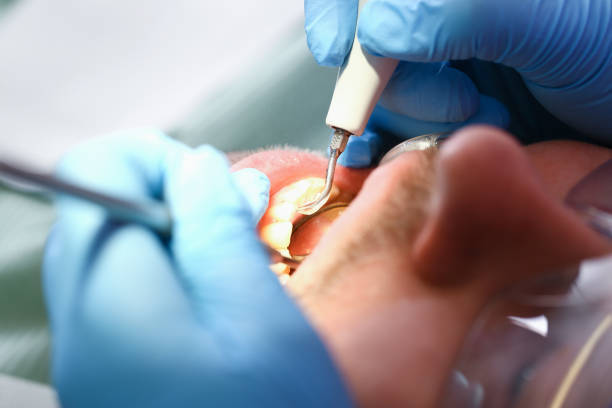Best Emergency Treatment for Oral Infections in Key Largo, FL