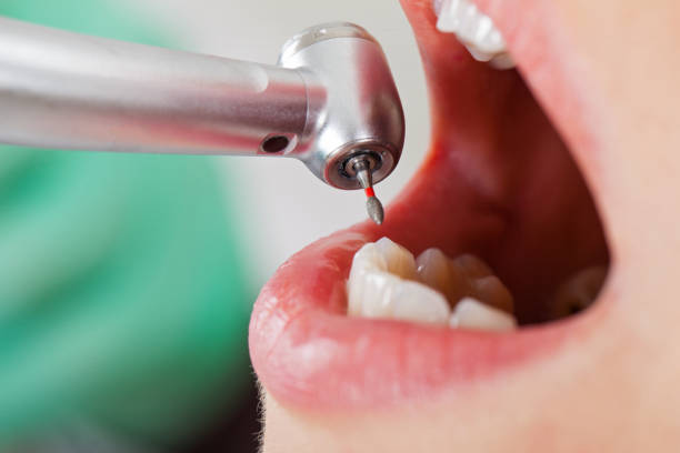 Best Broken or Chipped Tooth Repair in Key Largo, FL